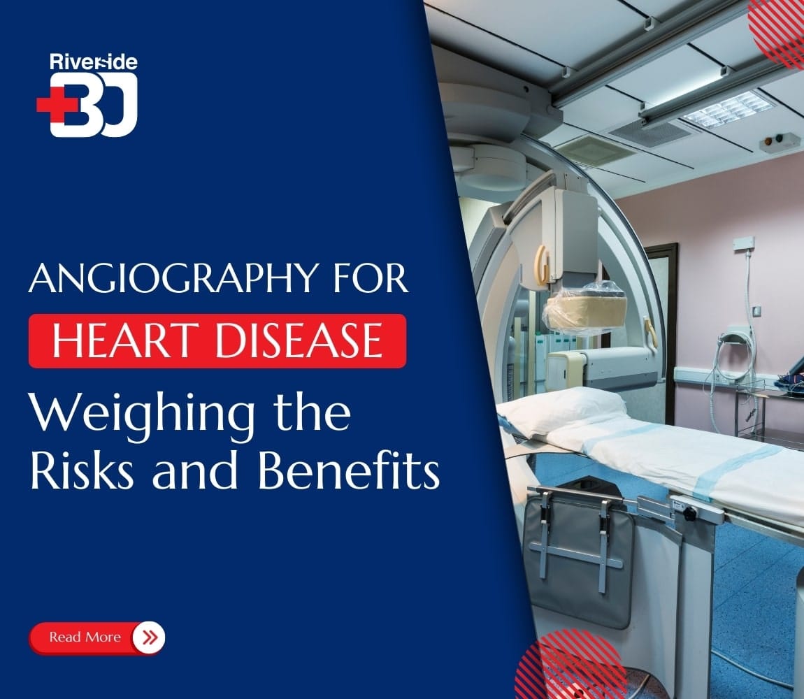 featured image of Angiography for heart disease