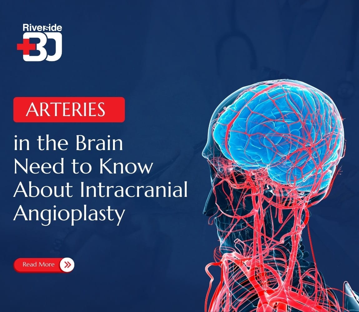 Arteries in the Brain