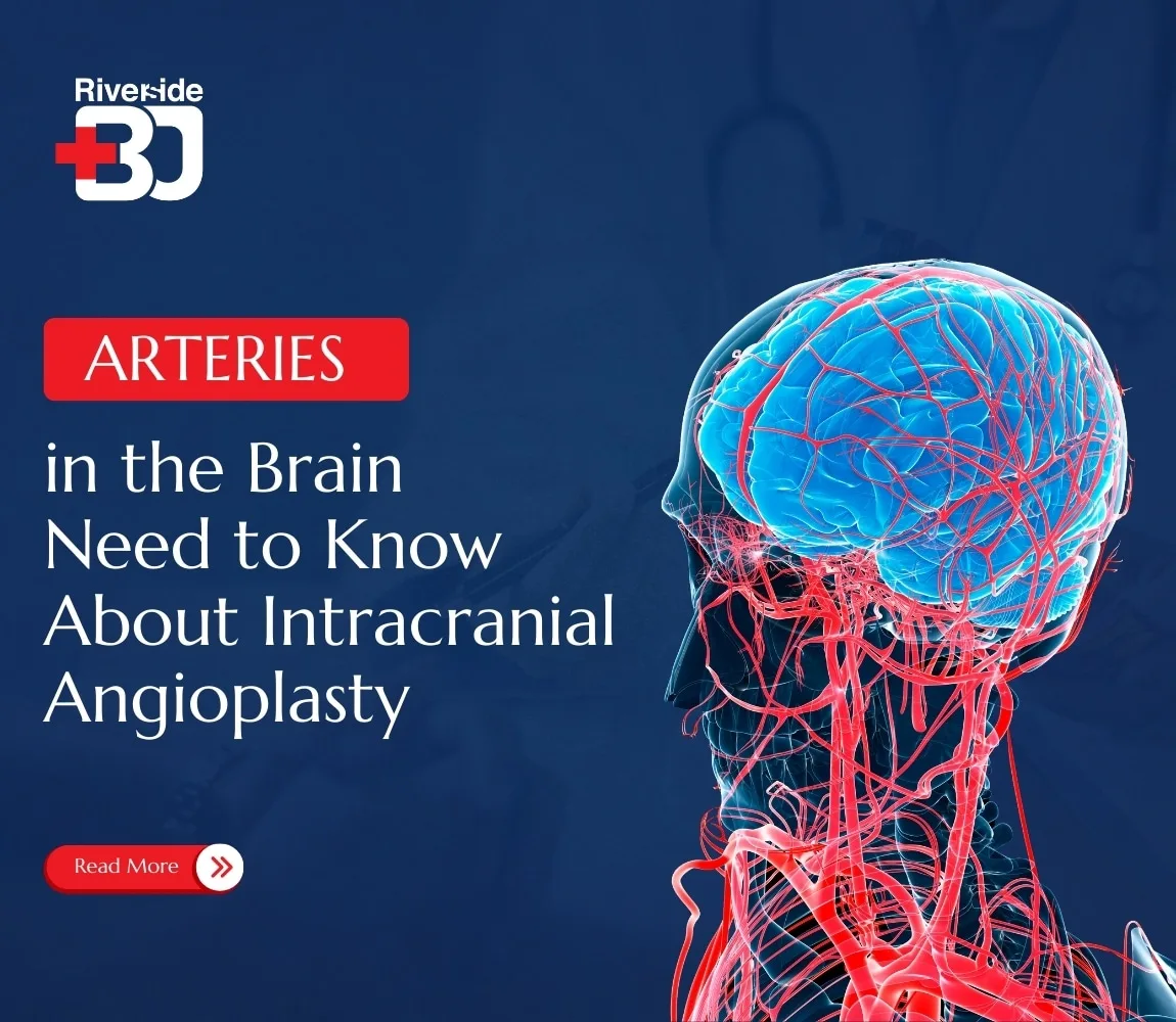Arteries in the Brain