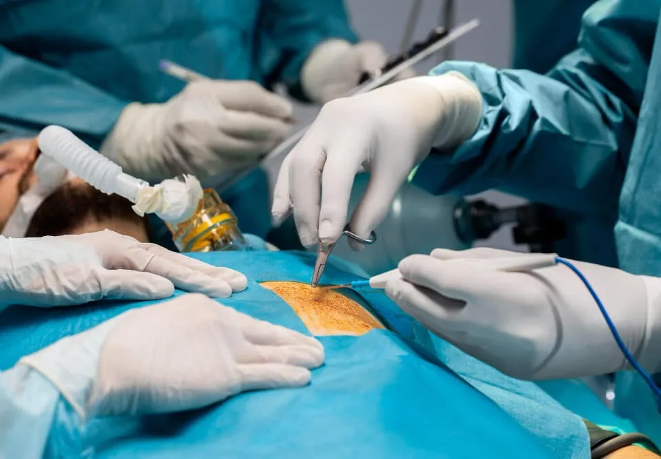 Bypass Surgery