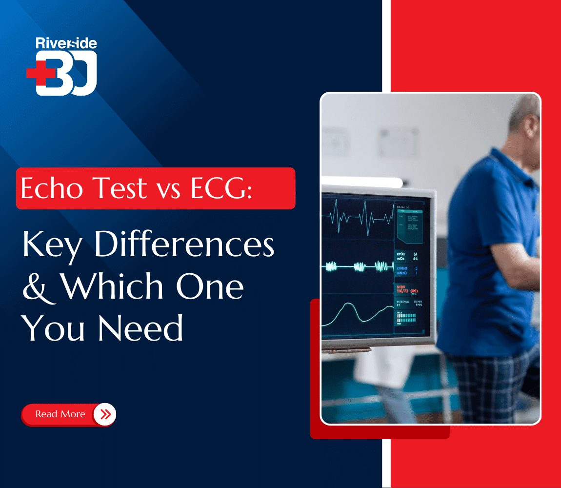 Echo test vs ECG