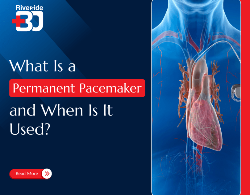 Permanent Pacemaker