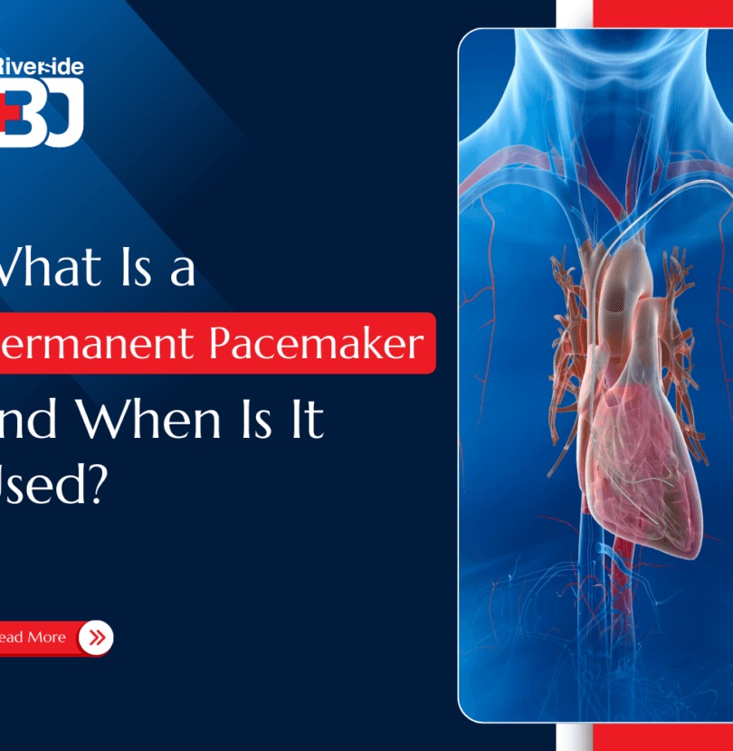 Permanent Pacemaker