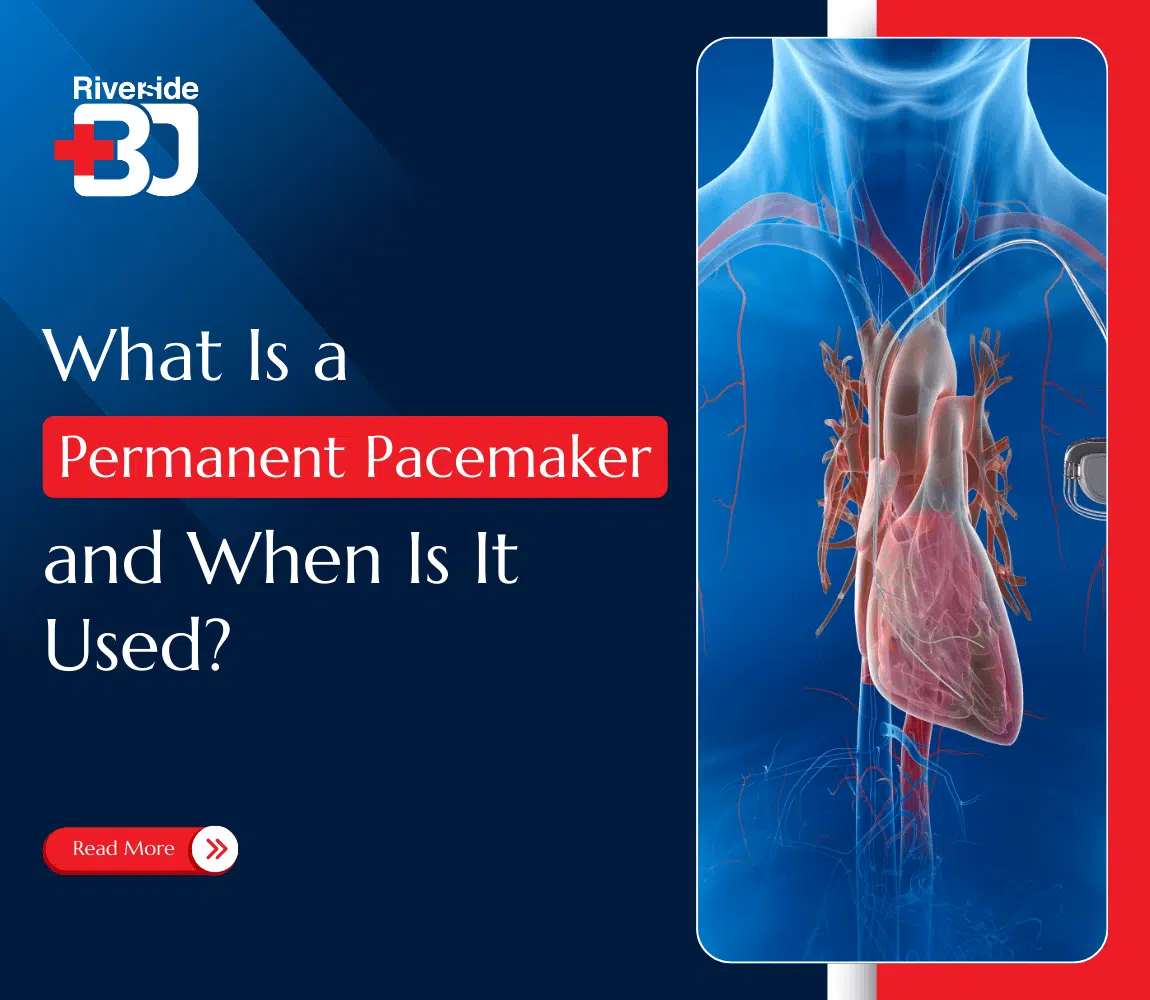 featured image of Permanent Pacemaker