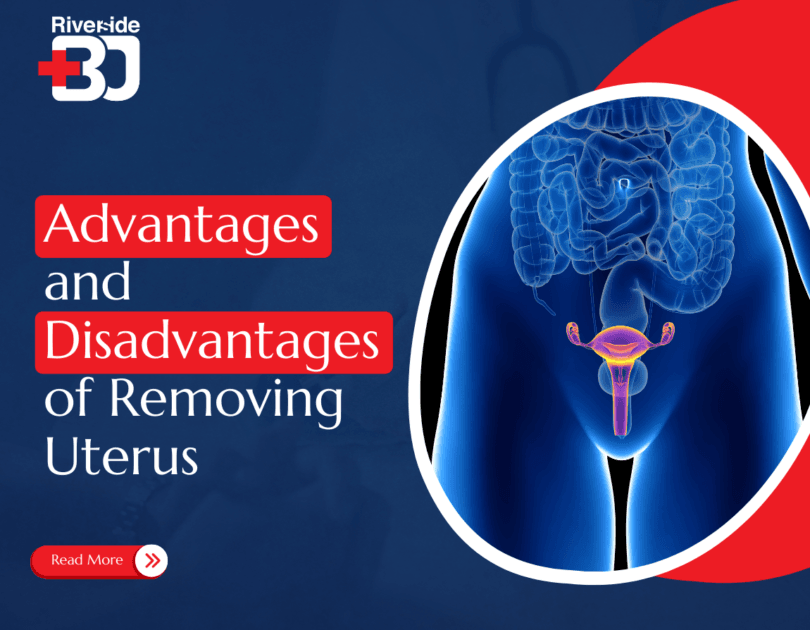 Advantages and disadvantages of removing uterus