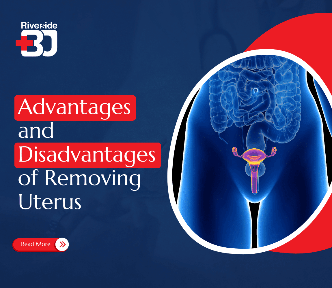 Advantages and disadvantages of removing uterus