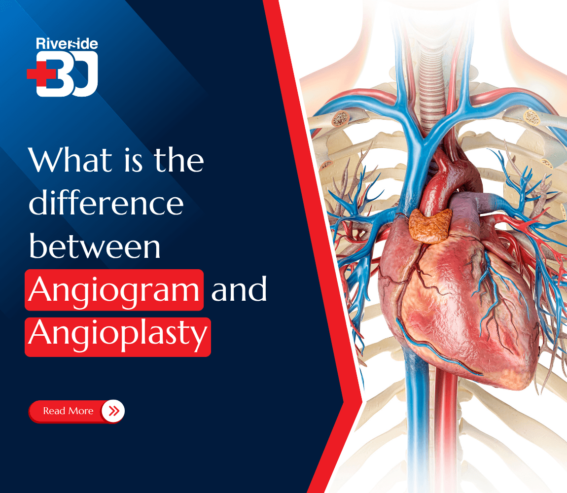 featured image of Angiogram vs Angioplasty banner