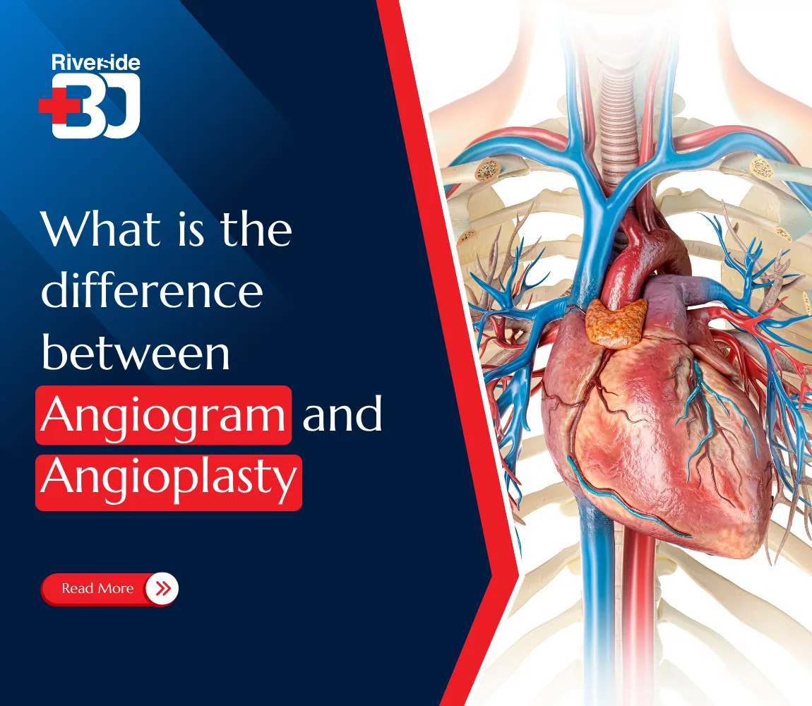 featured image of Angiogram vs Angioplasty banner