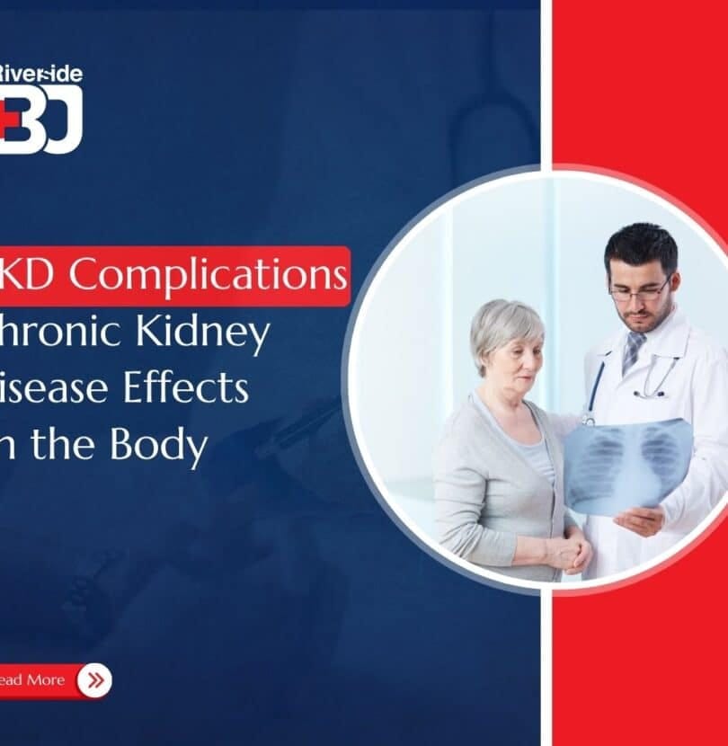 feature image on CKD Complications blog
