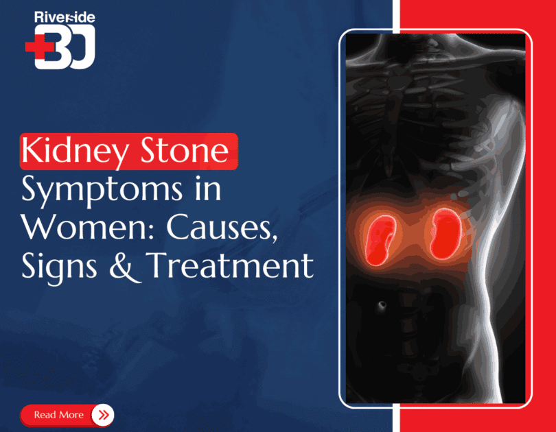Feature image of Kidney stone symptoms blog