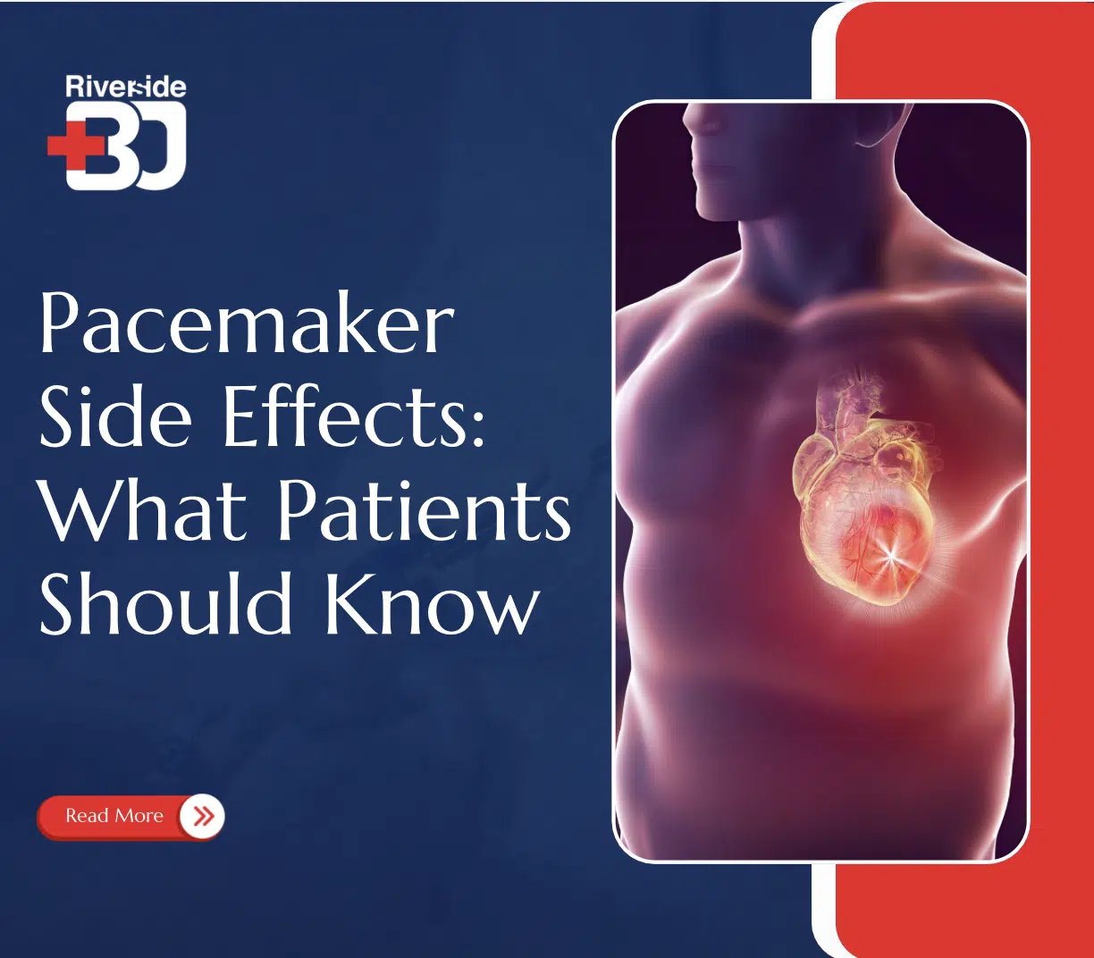 Pacemaker Side Effects