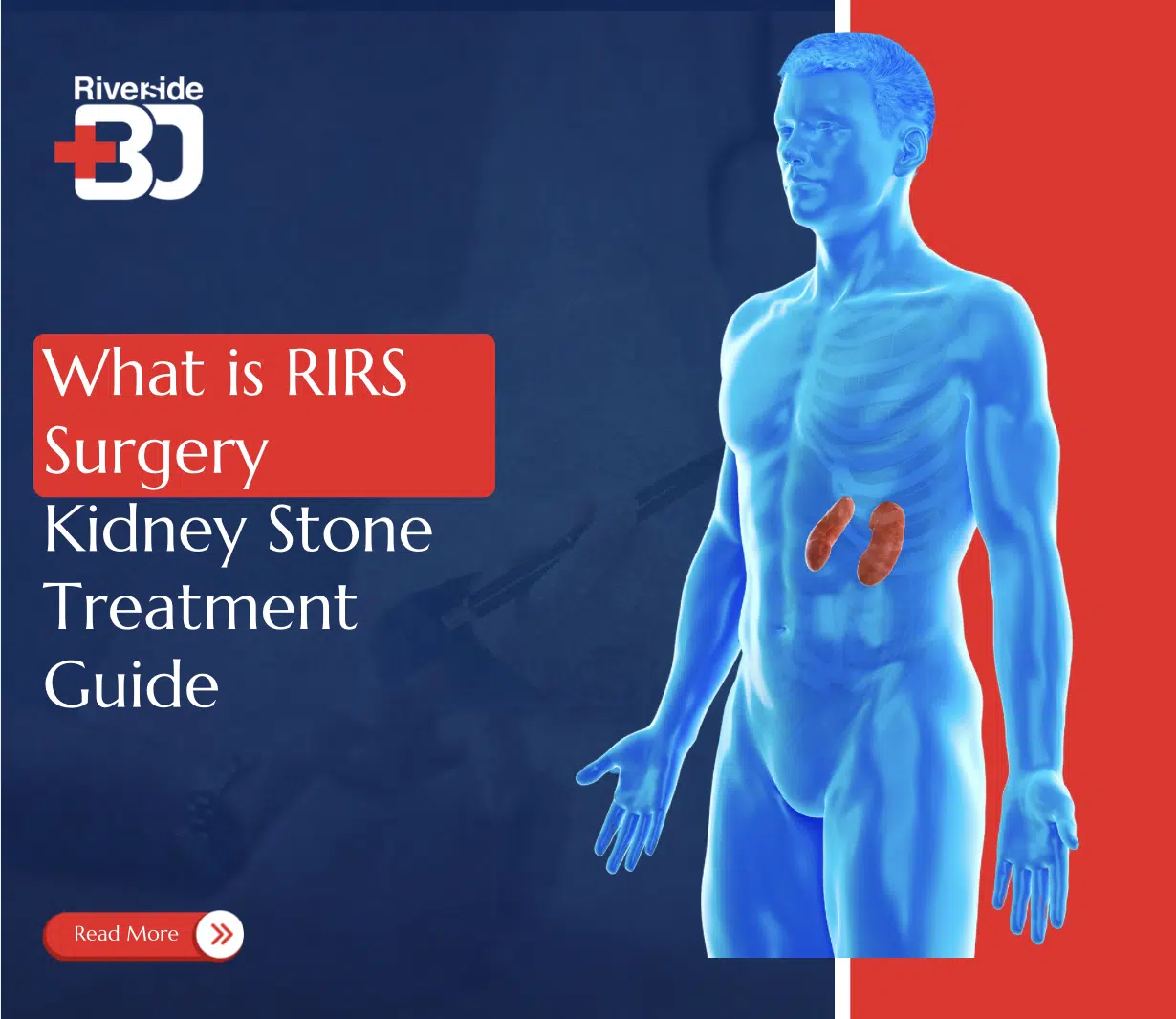 What is RIRS surgery