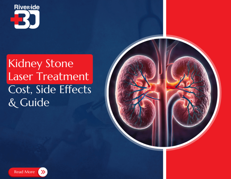 kidney stone laser treatment