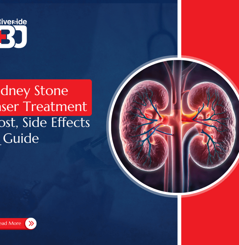 kidney stone laser treatment