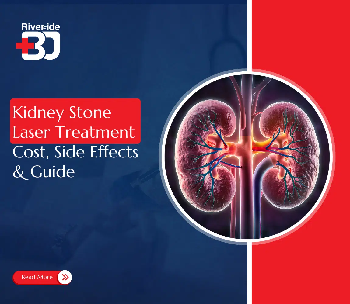 kidney stone laser treatment