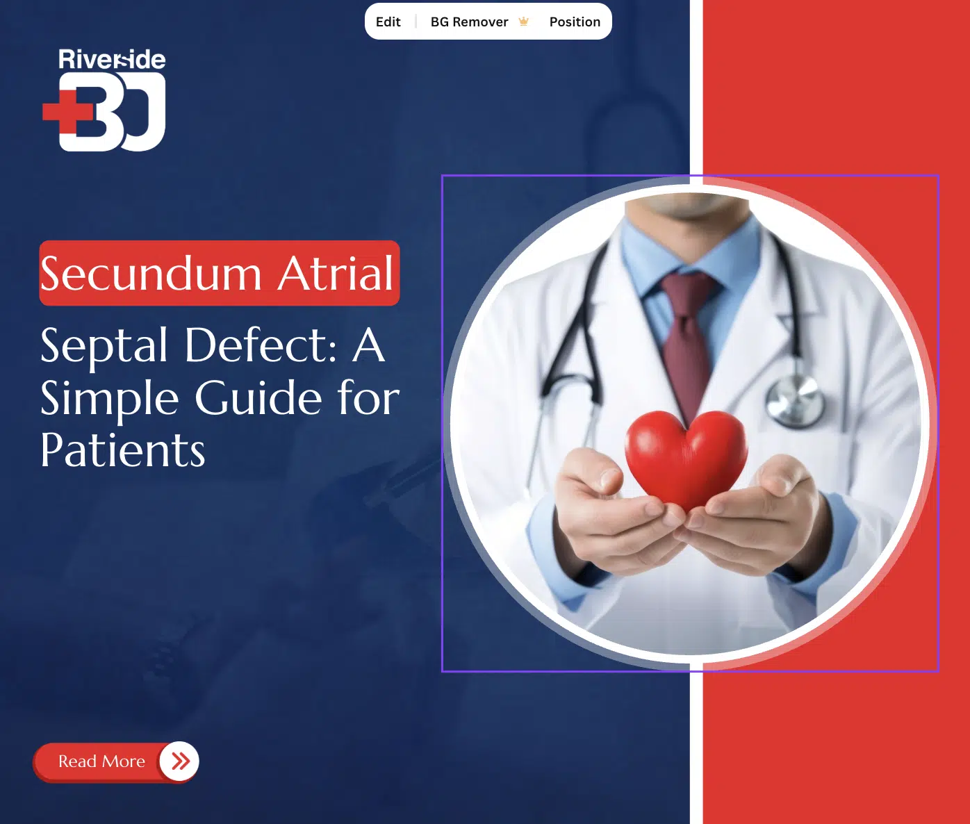 Secundum Atrial septal Defect