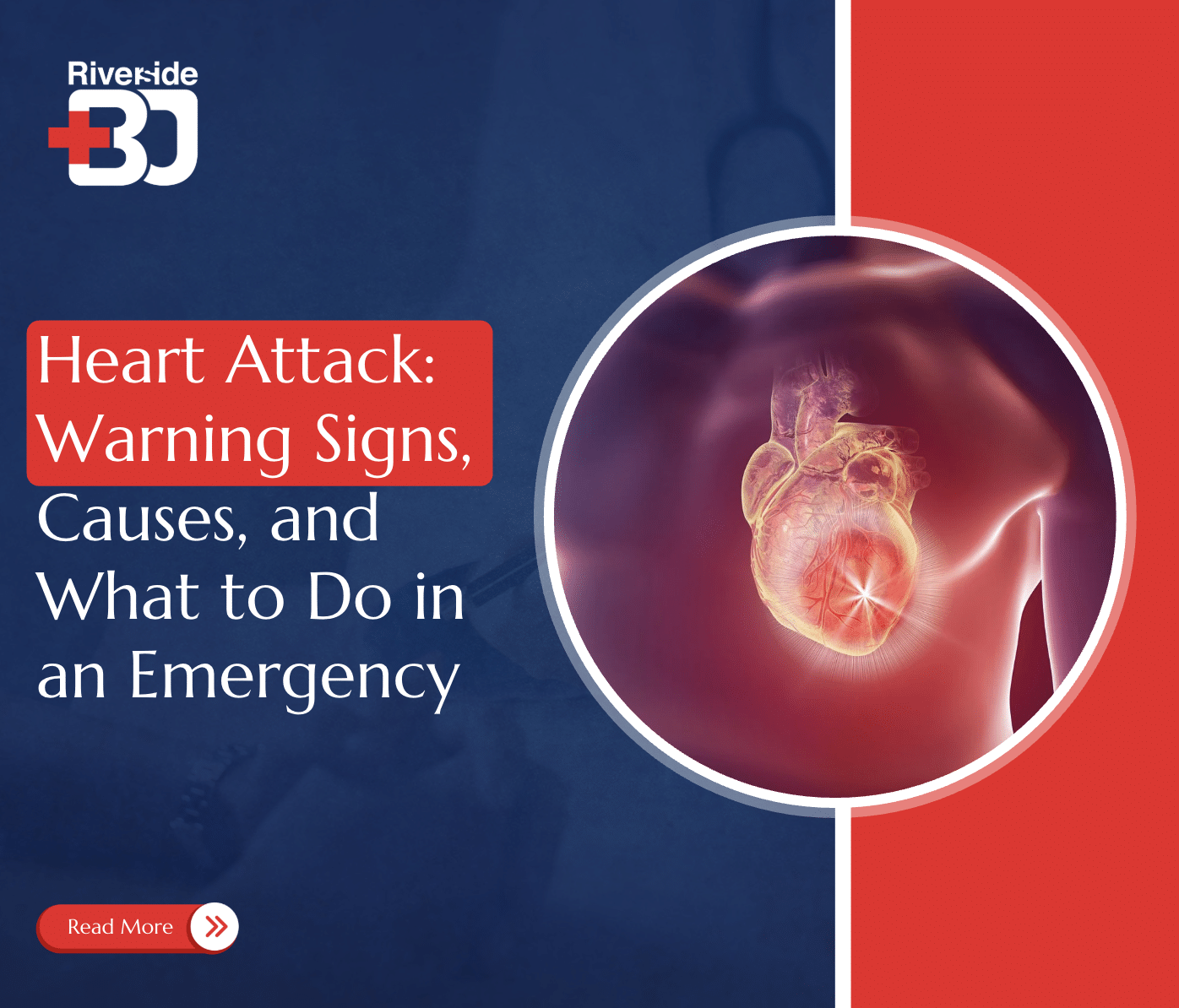 Heart Attack Symptoms