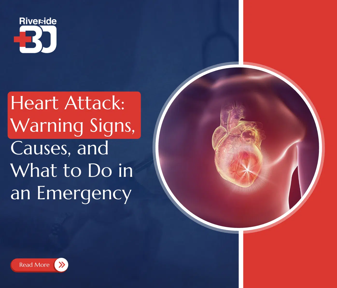 Heart Attack Symptoms