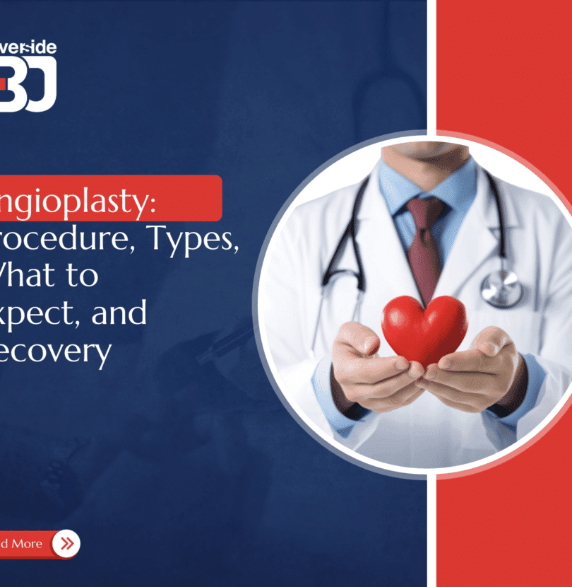 Angioplasty