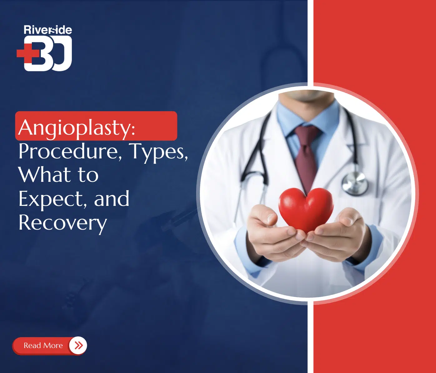 Angioplasty