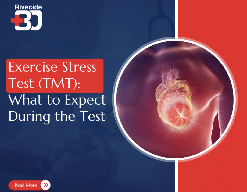 exercise stress test