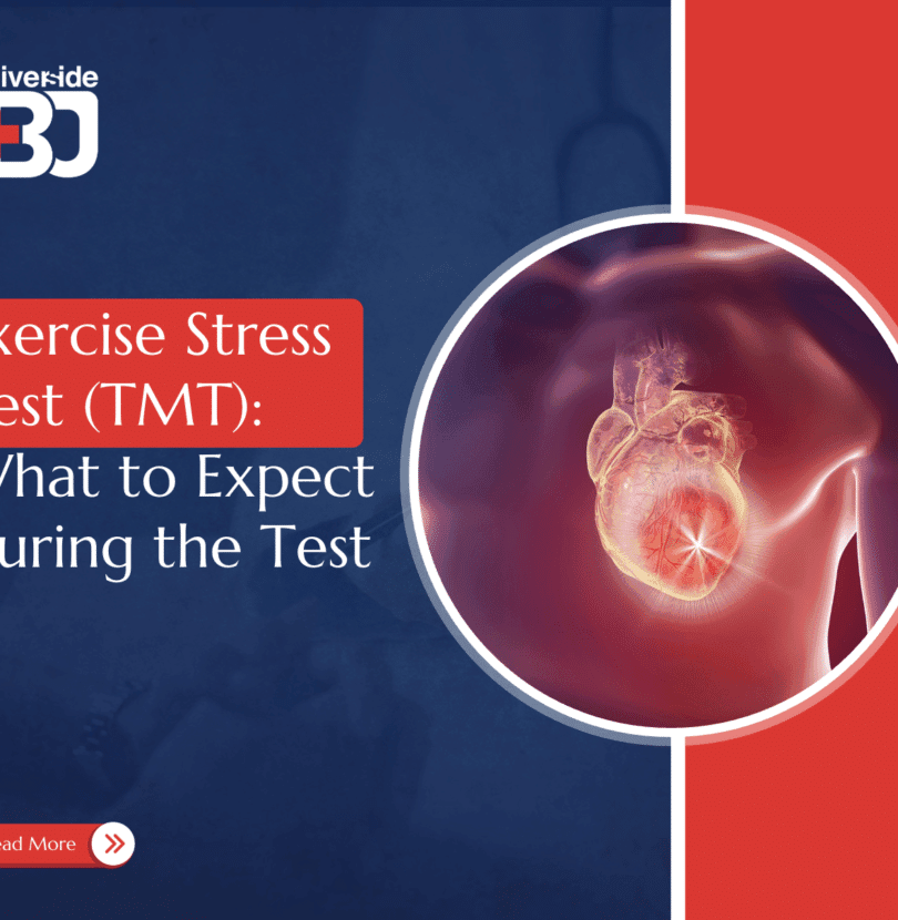 exercise stress test