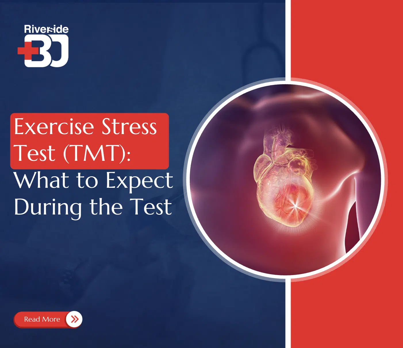 exercise stress test