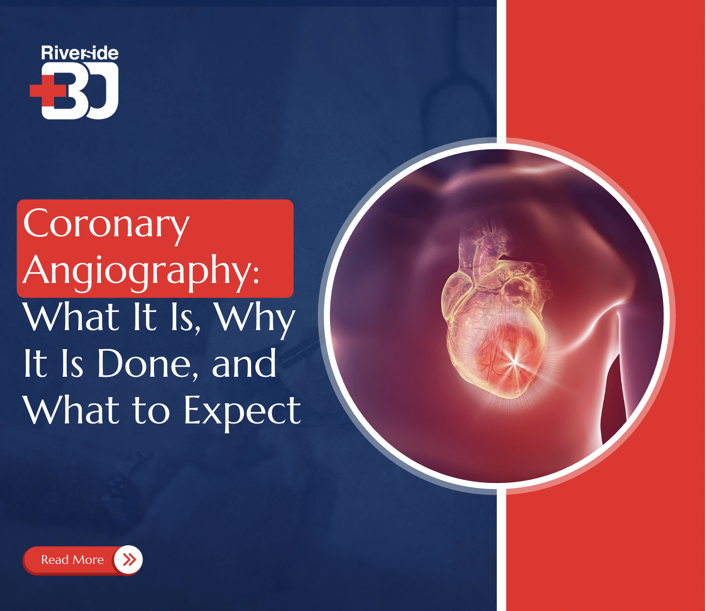 Coronary Angiography