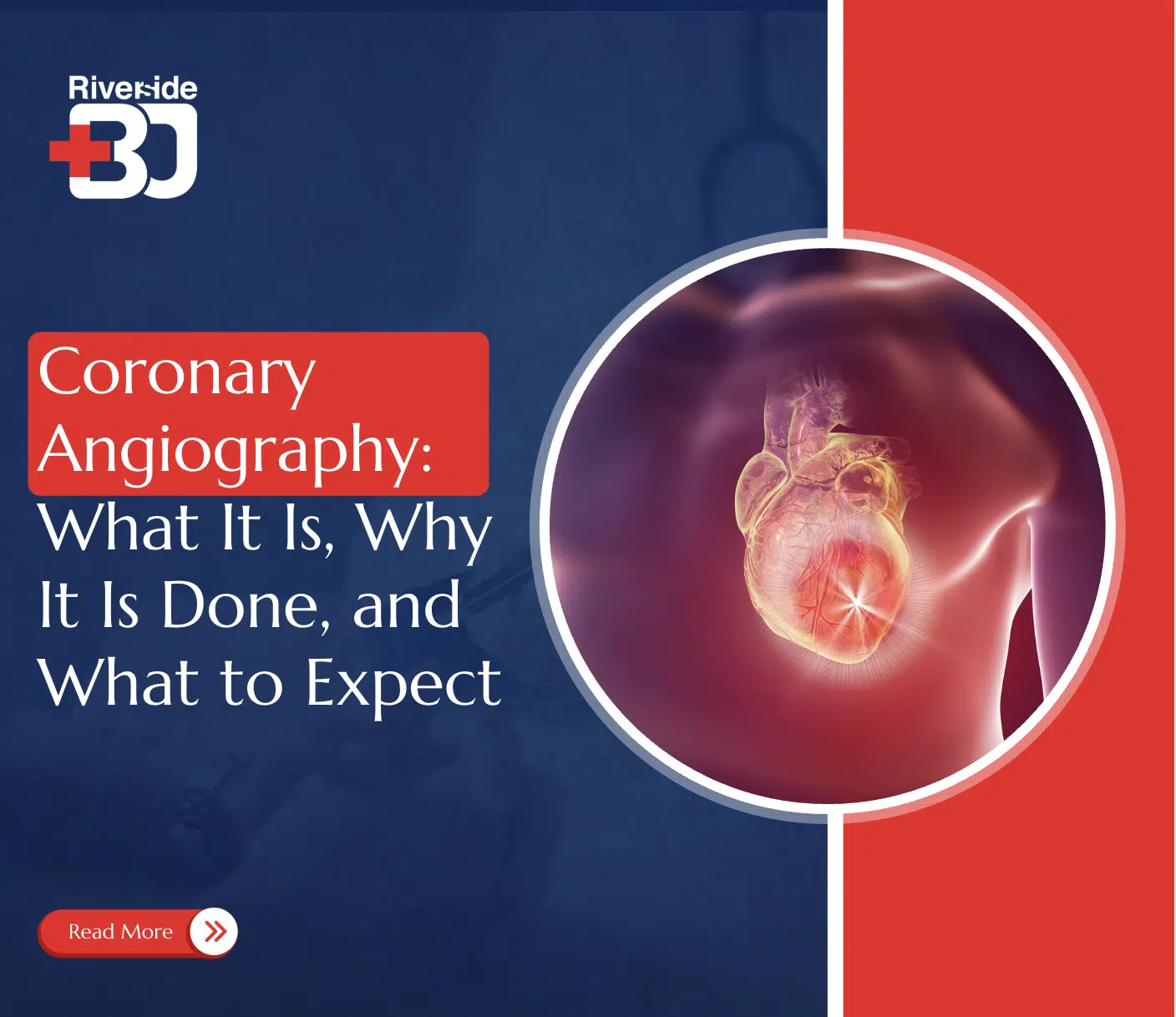 Coronary Angiography