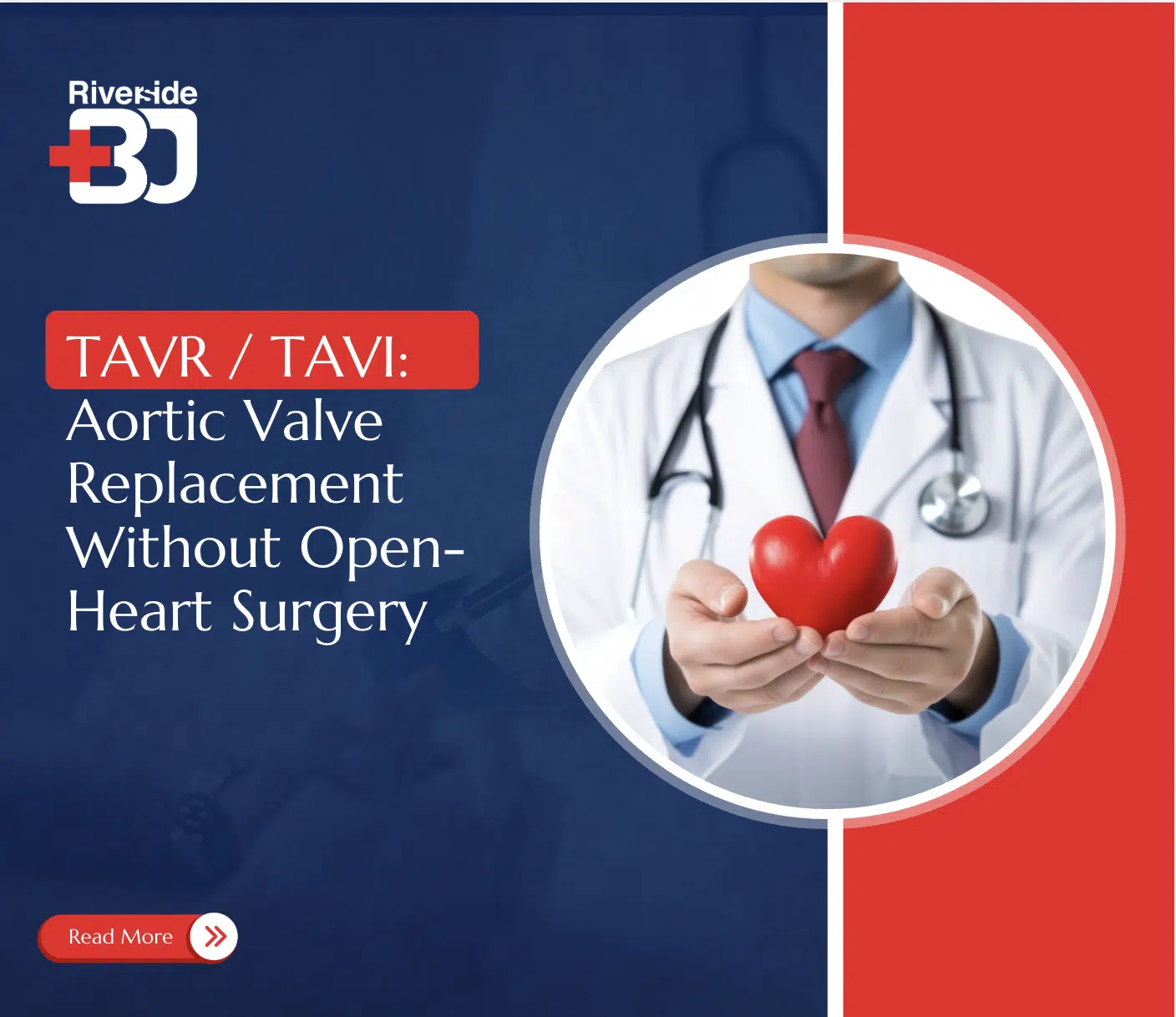 TAVR