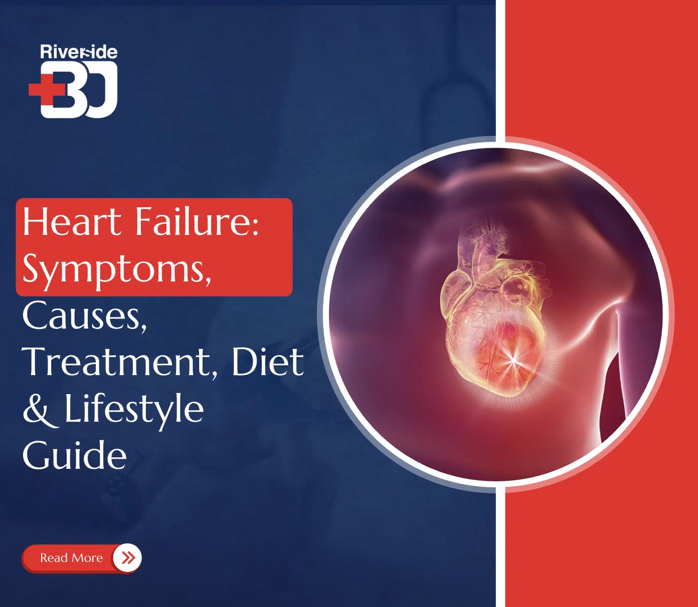 Heart failure symptoms