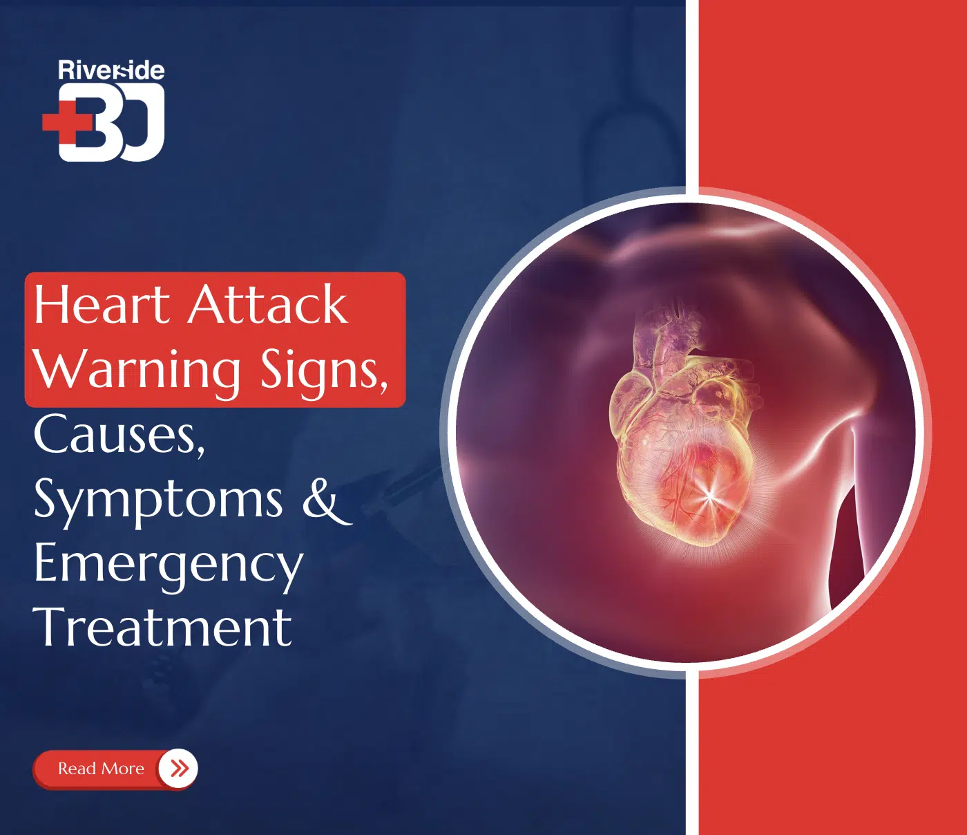 heart attack symptoms