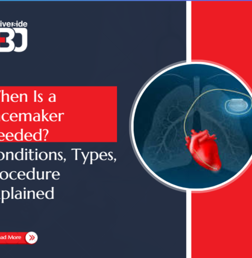 When Is a Pacemaker Needed - Conditions, Types, Procedure Explained