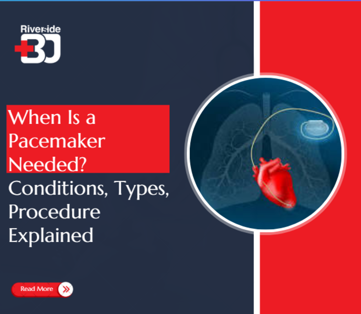 When Is a Pacemaker Needed - Conditions, Types, Procedure Explained